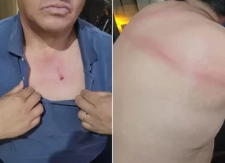 Piden prisión preventiva para padre e hija por agredir a un inspector municipal